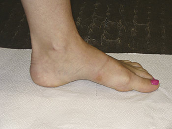 foot1